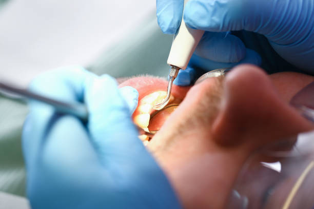Best Emergency Treatment for Jaw Pain or Injury in Dillsburg, PA